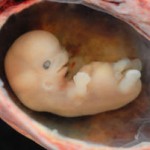 Supreme Court Allows Continued Destruction of Human Embryos