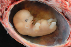 Human Embryo - Approximately 8 weeks estimated gestational age